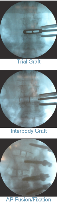 Procedure Xrays